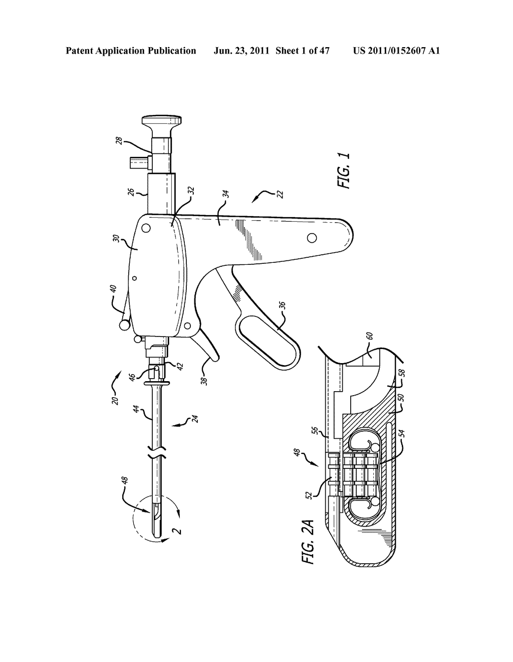 Apparatus and Method for Manipulating or Retracting Tissue and Anatomical     Structure - diagram, schematic, and image 02