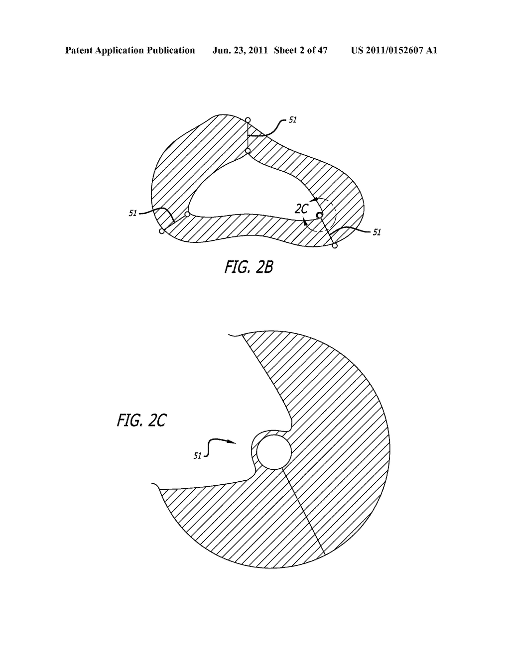 Apparatus and Method for Manipulating or Retracting Tissue and Anatomical     Structure - diagram, schematic, and image 03