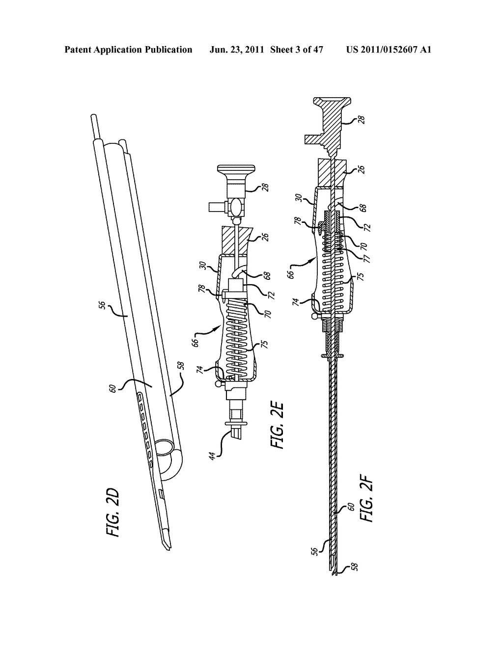 Apparatus and Method for Manipulating or Retracting Tissue and Anatomical     Structure - diagram, schematic, and image 04