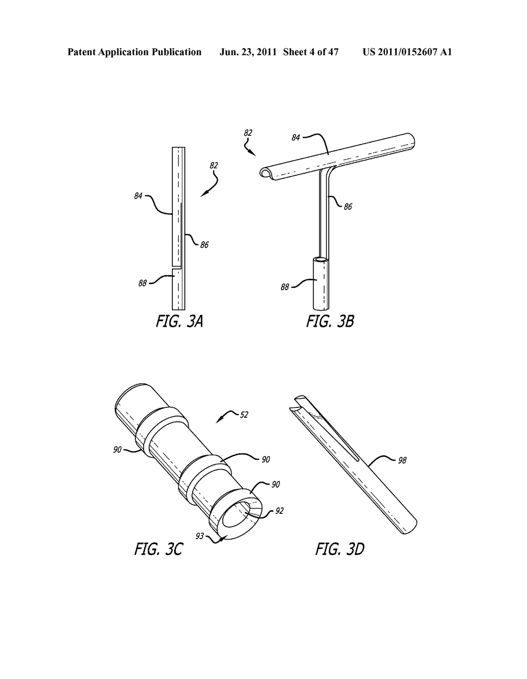 Apparatus and Method for Manipulating or Retracting Tissue and Anatomical     Structure - diagram, schematic, and image 05