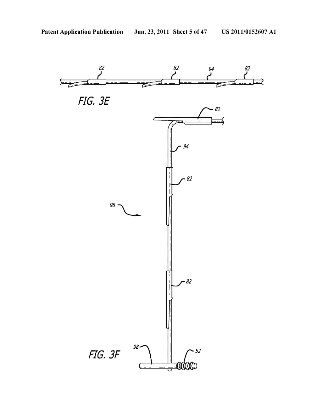 Apparatus and Method for Manipulating or Retracting Tissue and Anatomical     Structure - diagram, schematic, and image 06