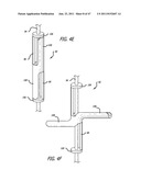 Apparatus and Method for Manipulating or Retracting Tissue and Anatomical     Structure diagram and image