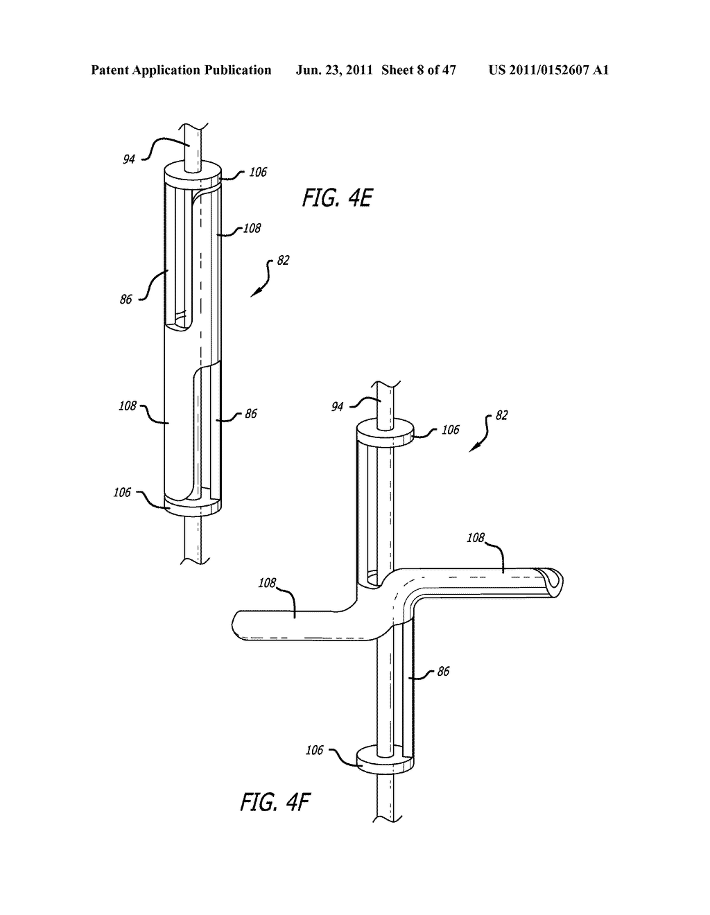 Apparatus and Method for Manipulating or Retracting Tissue and Anatomical     Structure - diagram, schematic, and image 09