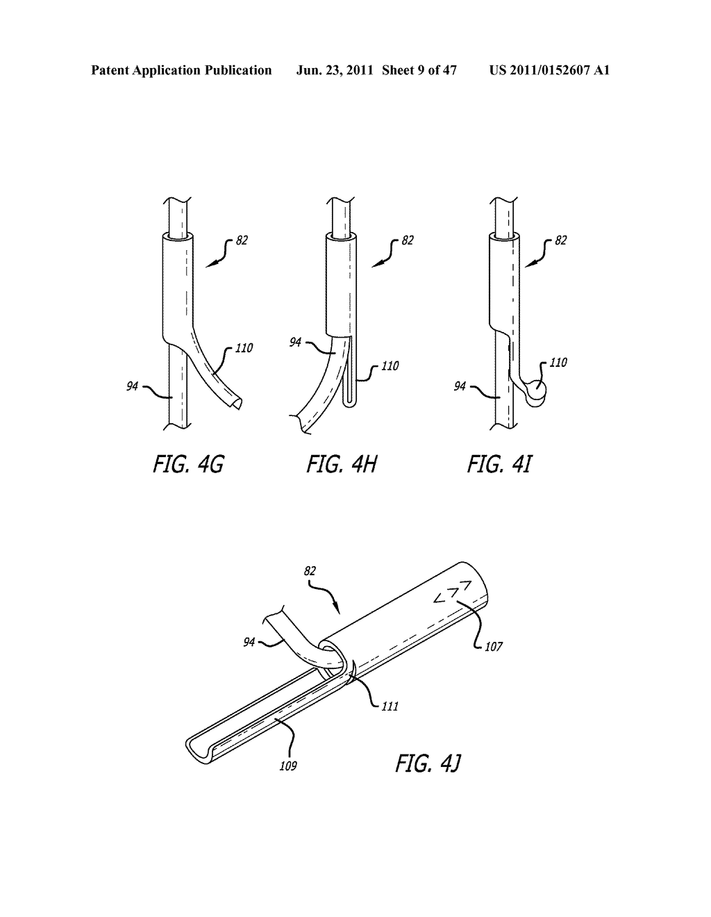 Apparatus and Method for Manipulating or Retracting Tissue and Anatomical     Structure - diagram, schematic, and image 10