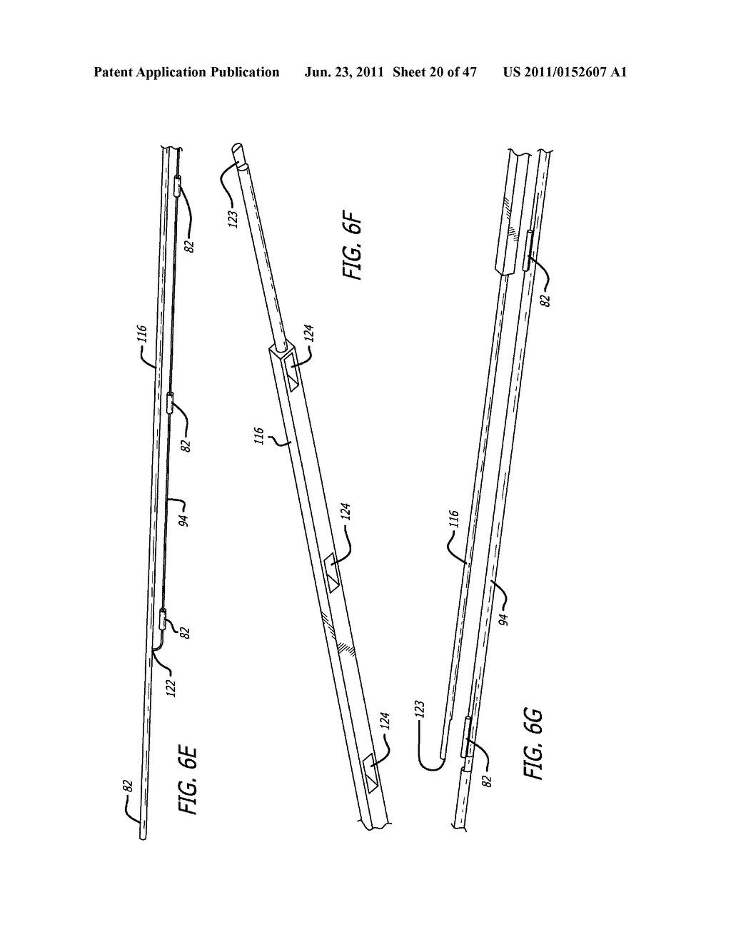 Apparatus and Method for Manipulating or Retracting Tissue and Anatomical     Structure - diagram, schematic, and image 21