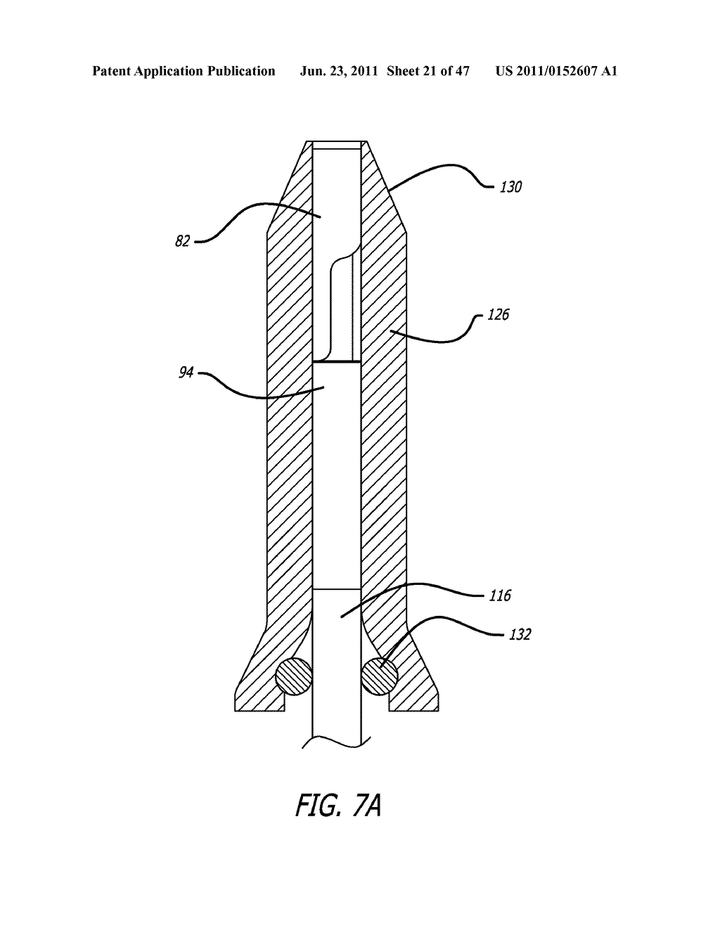 Apparatus and Method for Manipulating or Retracting Tissue and Anatomical     Structure - diagram, schematic, and image 22