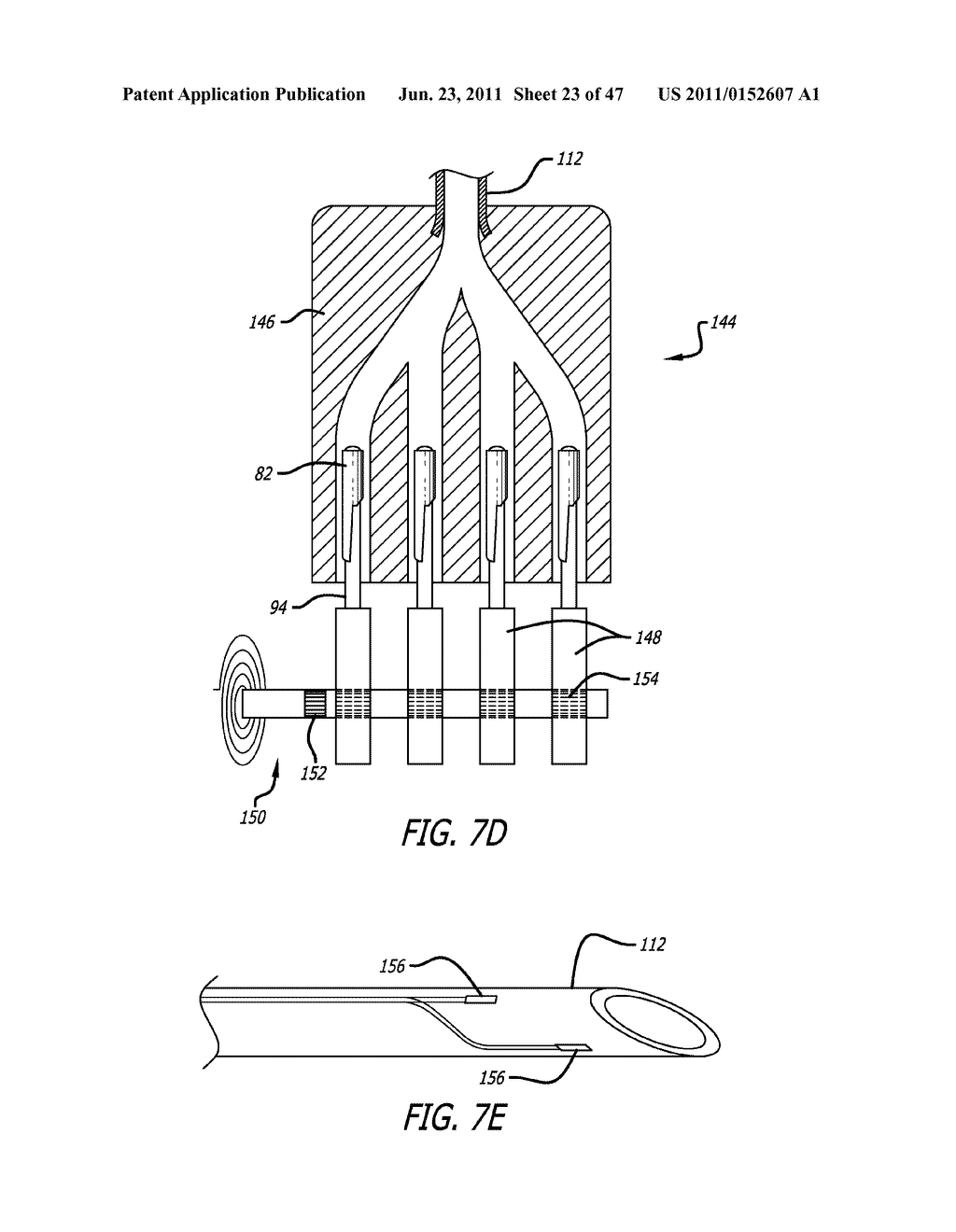 Apparatus and Method for Manipulating or Retracting Tissue and Anatomical     Structure - diagram, schematic, and image 24