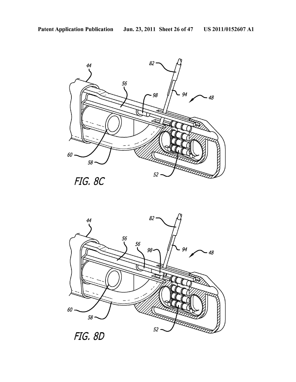 Apparatus and Method for Manipulating or Retracting Tissue and Anatomical     Structure - diagram, schematic, and image 27