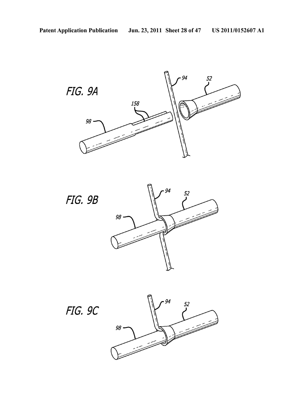 Apparatus and Method for Manipulating or Retracting Tissue and Anatomical     Structure - diagram, schematic, and image 29