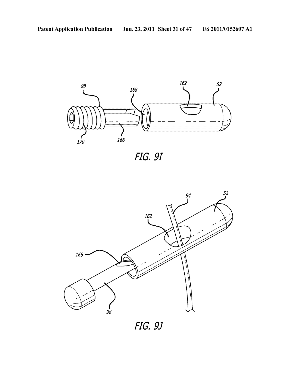 Apparatus and Method for Manipulating or Retracting Tissue and Anatomical     Structure - diagram, schematic, and image 32