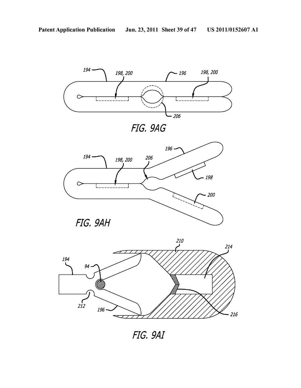 Apparatus and Method for Manipulating or Retracting Tissue and Anatomical     Structure - diagram, schematic, and image 40