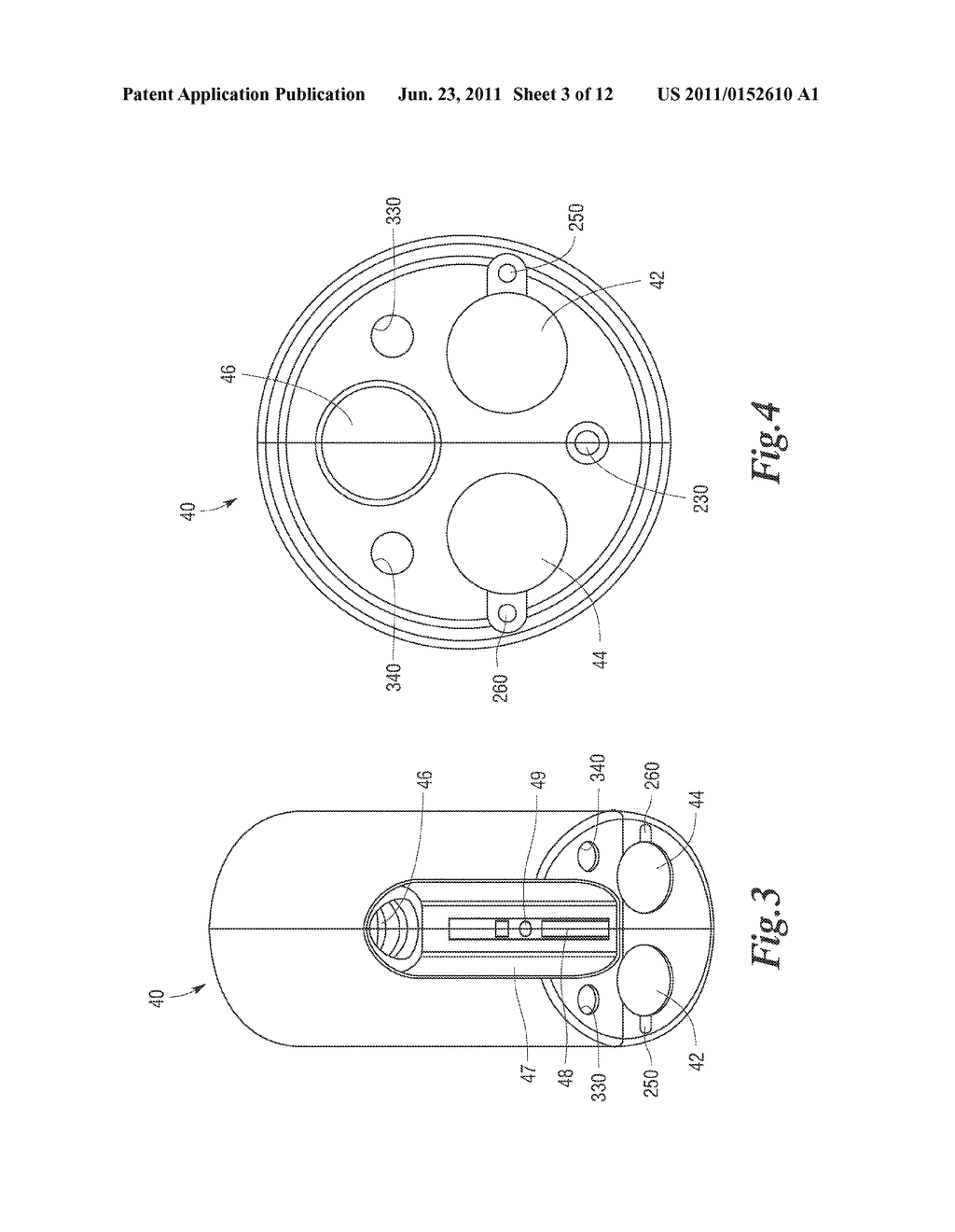 INTRALUMENAL ACCESSORY TIP FOR ENDOSCOPIC SHEATH ARRANGEMENTS - diagram, schematic, and image 04