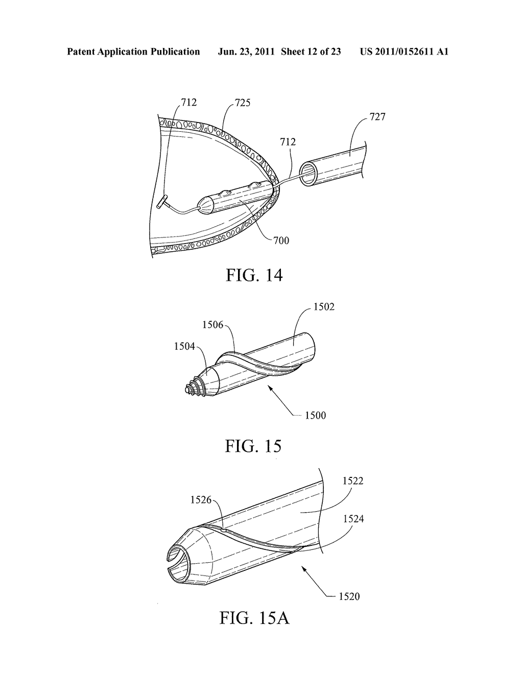 SYSTEM AND METHOD FOR FIDUCIAL DEPLOYMENT - diagram, schematic, and image 13