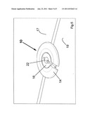 DEVICE FOR SECURING A CRANIAL LIMB TO THE CRANIAL TOP AND FOR     SIMULTANEOUSLY CLOSING CRANIOTOMY HOLES, AND PROCESS FOR USING IT diagram and image