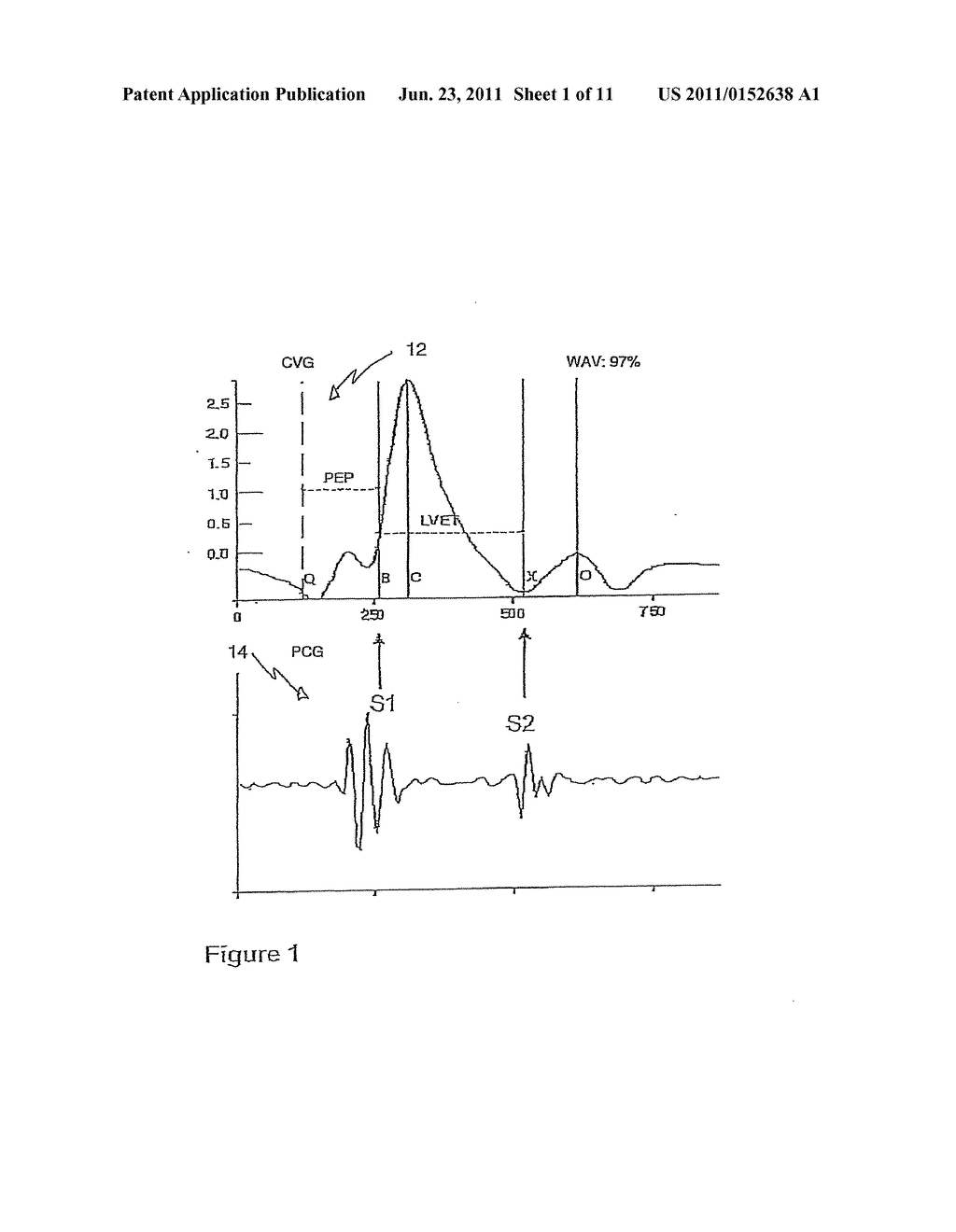 CARDIOGRAPHY SYSTEM AND METHOD USING AUTOMATED RECOGNITION OF HEMODYNAMIC     PARAMETERS AND WAVEFORM ATTRIBUTES - diagram, schematic, and image 02