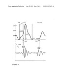 CARDIOGRAPHY SYSTEM AND METHOD USING AUTOMATED RECOGNITION OF HEMODYNAMIC     PARAMETERS AND WAVEFORM ATTRIBUTES diagram and image