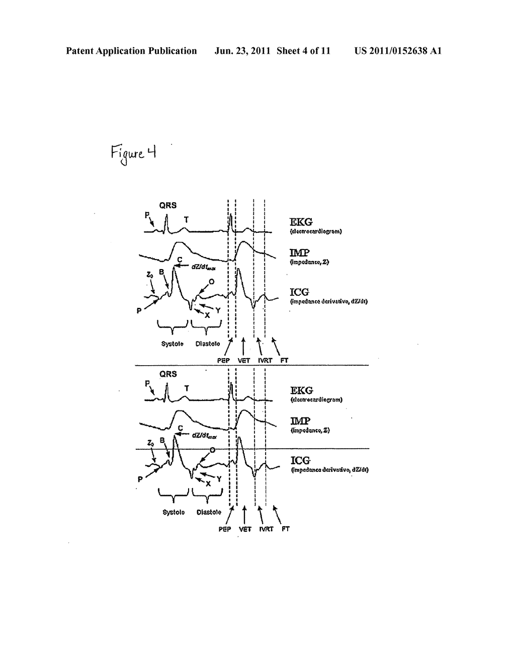 CARDIOGRAPHY SYSTEM AND METHOD USING AUTOMATED RECOGNITION OF HEMODYNAMIC     PARAMETERS AND WAVEFORM ATTRIBUTES - diagram, schematic, and image 05