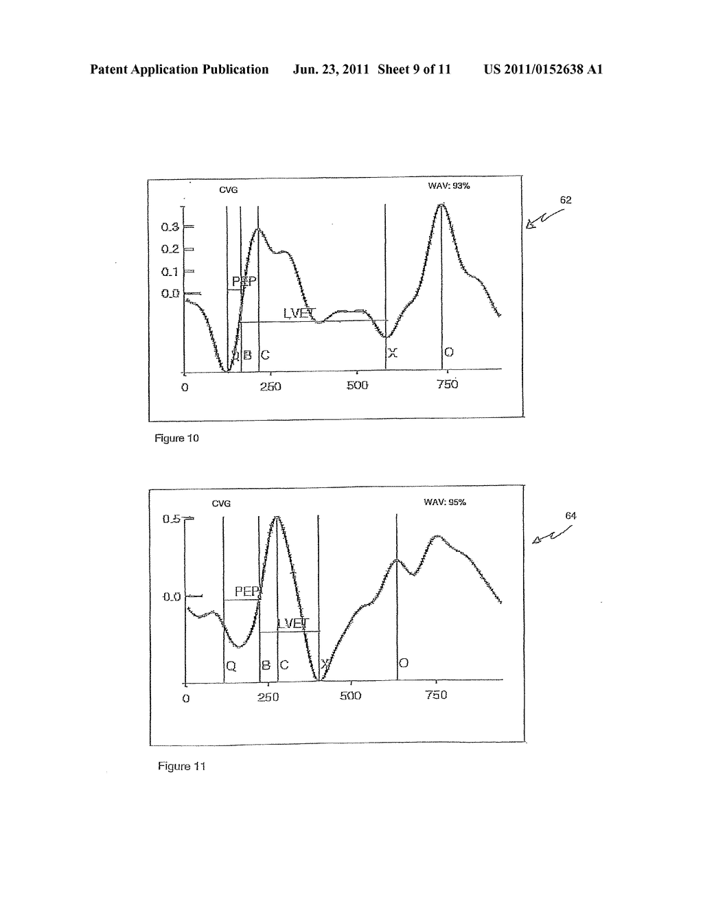 CARDIOGRAPHY SYSTEM AND METHOD USING AUTOMATED RECOGNITION OF HEMODYNAMIC     PARAMETERS AND WAVEFORM ATTRIBUTES - diagram, schematic, and image 10