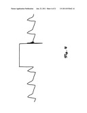 DETECTION OF BUBBLES DURING HEMODYNAMIC MONITORING WHEN PERFORMING     AUTOMATED MEASUREMENT OF BLOOD CONSTITUENTS diagram and image