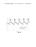 DETECTION OF BUBBLES DURING HEMODYNAMIC MONITORING WHEN PERFORMING     AUTOMATED MEASUREMENT OF BLOOD CONSTITUENTS diagram and image