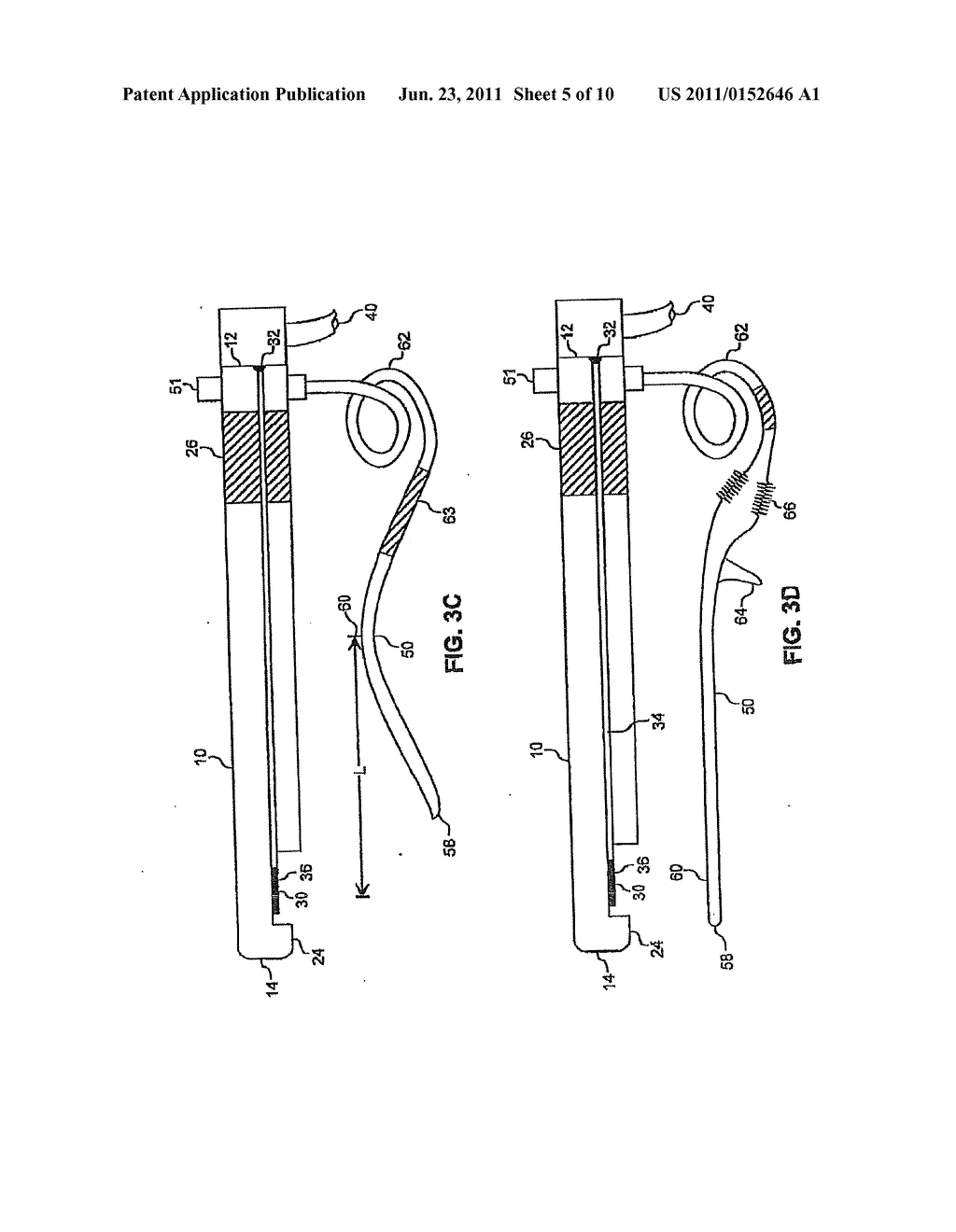 NONINVASIVE DETECTION OF A PHYSIOLOGIC PARAMETER WITH A PROBE - diagram, schematic, and image 06