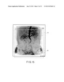 MAGNETIC RESONANCE IMAGING APPARATUS diagram and image