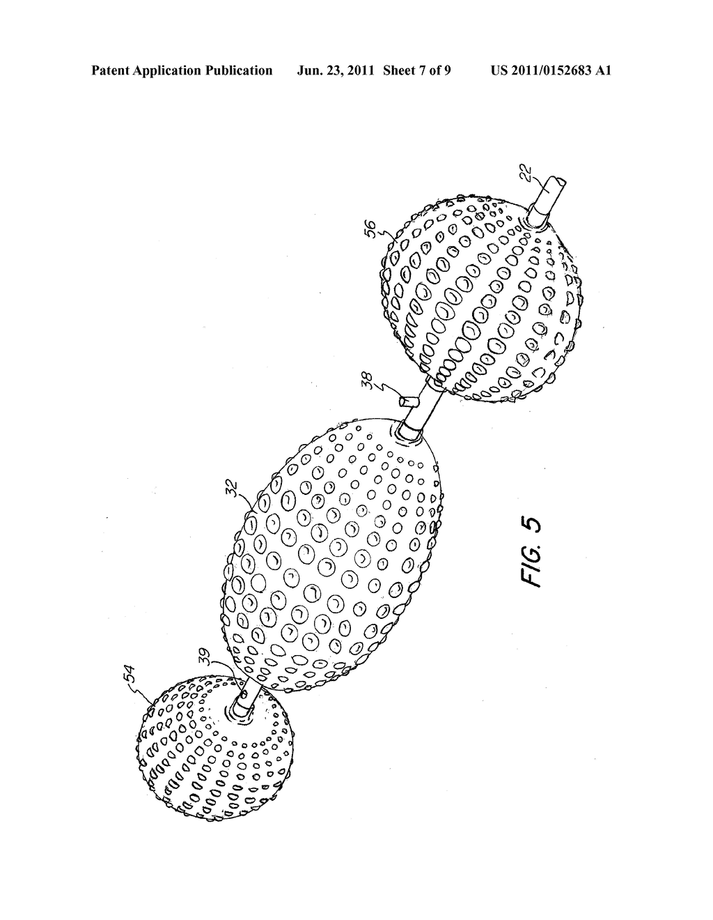 Abrading Balloon Catheter for Extravasated Drug Delivery - diagram, schematic, and image 08