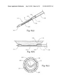 BIOPSY NEEDLE WITH VACUUM ASSIST diagram and image