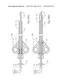 BIOPSY NEEDLE WITH VACUUM ASSIST diagram and image