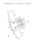 Brace having a Force Indicator diagram and image