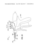 USE OF BIOMARKERS AND THERAPEUTIC AGENTS WITH SURGICAL DEVICES diagram and image