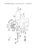 USE OF BIOMARKERS AND THERAPEUTIC AGENTS WITH SURGICAL DEVICES diagram and image