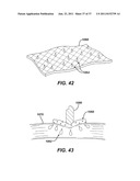 USE OF BIOMARKERS AND THERAPEUTIC AGENTS WITH SURGICAL DEVICES diagram and image