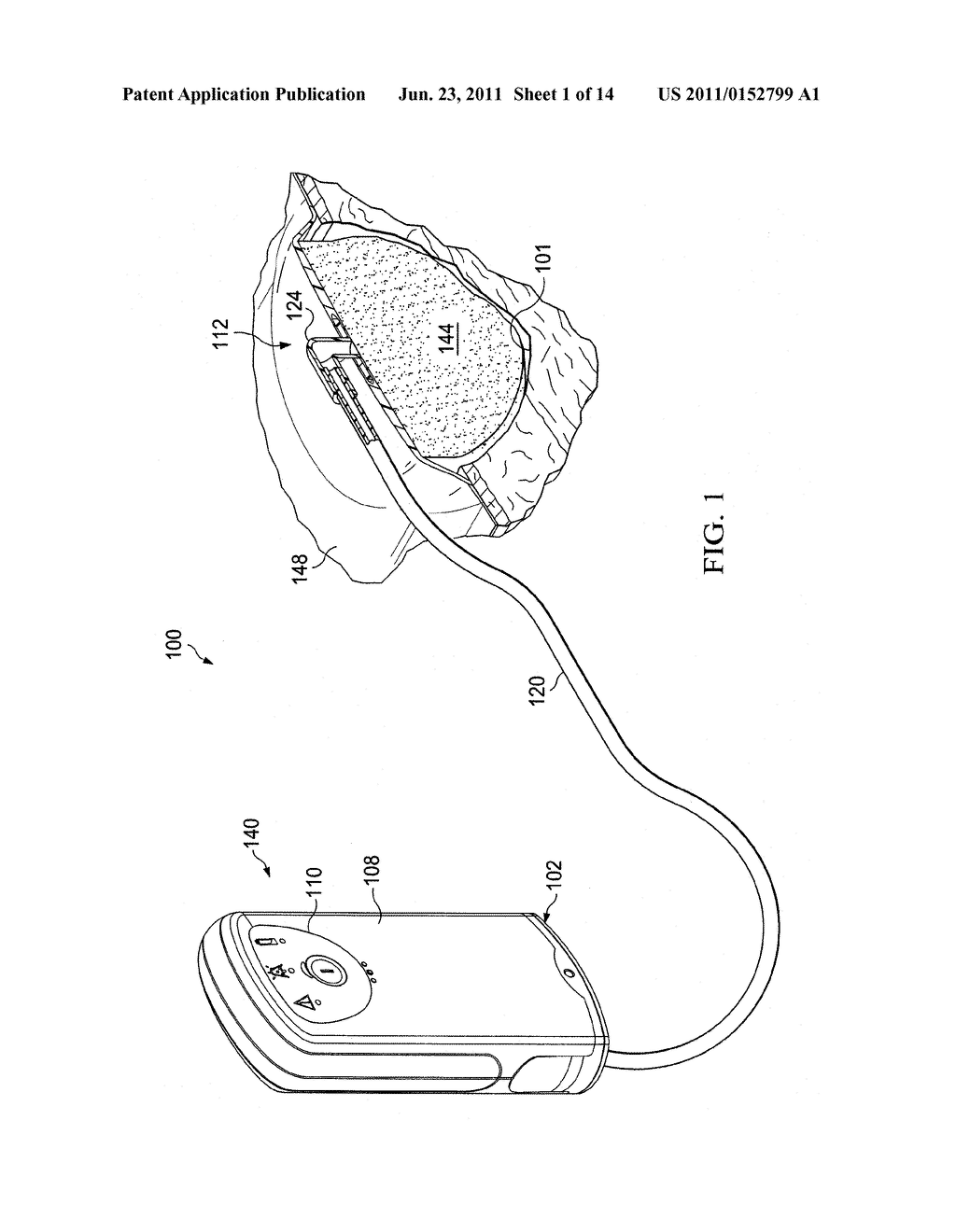 REDUCED-PRESSURE, MULTI-ORIENTATION, LIQUID-COLLECTION CANISTER - diagram, schematic, and image 02