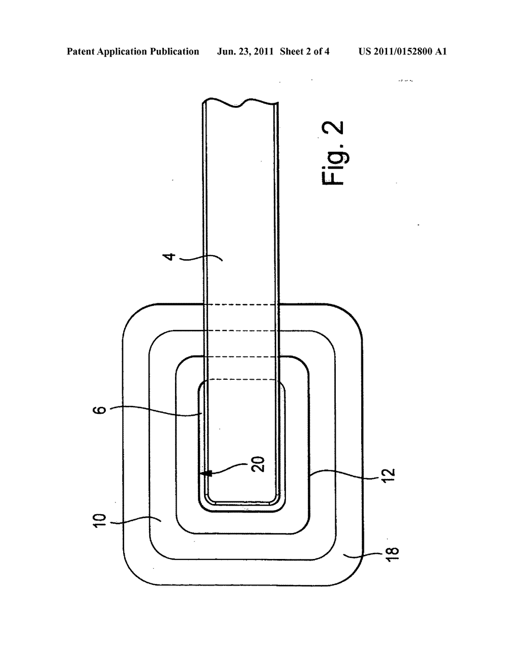 Attachment device for use in the vacuum therapy of wounds - diagram, schematic, and image 03