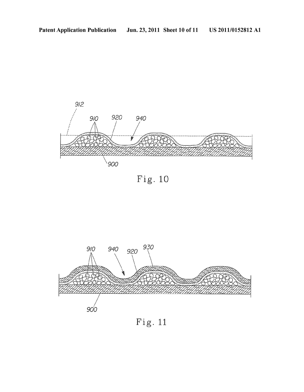 Absorbent Article Comprising A Synthetic Polymer Derived From A Renewable     Resource And Methods Of Producing Said Article - diagram, schematic, and image 11