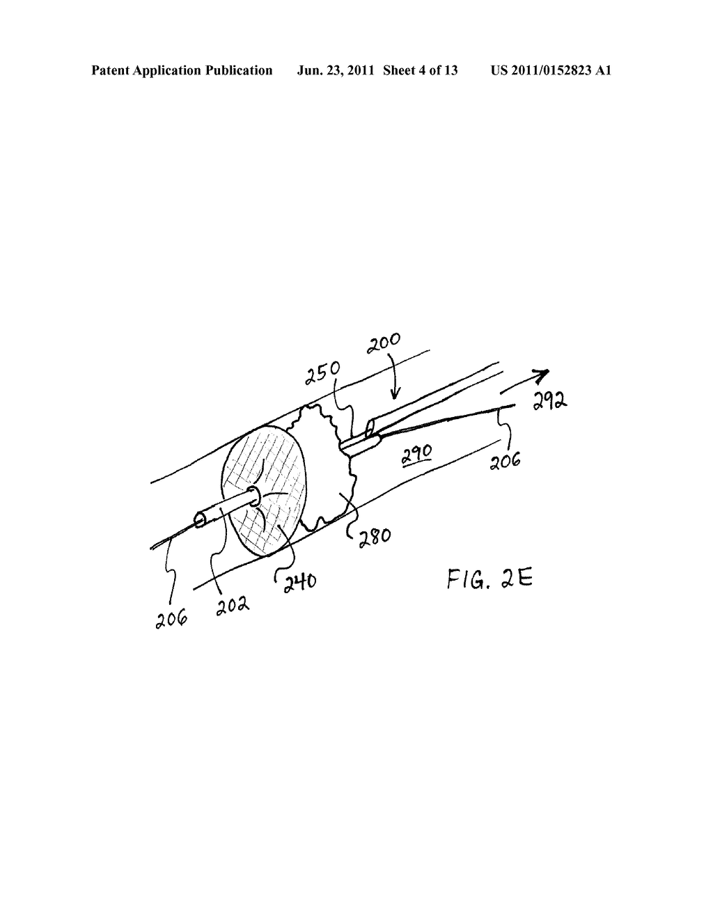 THROMBUS REMOVAL DEVICE AND SYSTEM - diagram, schematic, and image 05