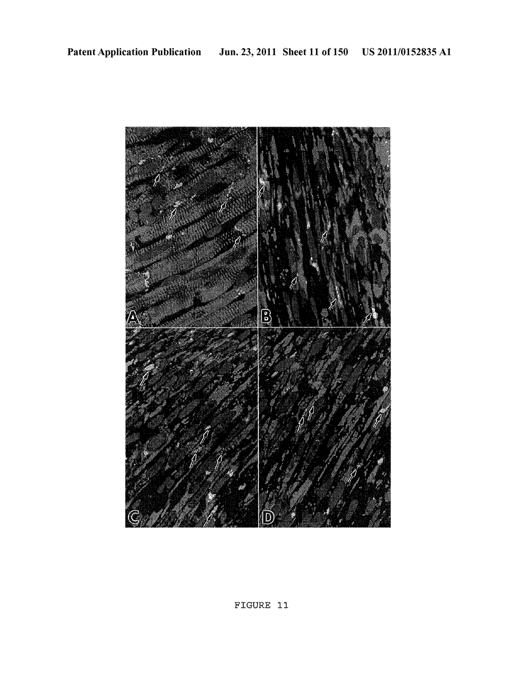 METHODS AND COMPOSITIONS FOR THE REPAIR AND/OR REGENERATION OF DAMAGED     MYOCARDIUM - diagram, schematic, and image 12