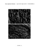 METHODS AND COMPOSITIONS FOR THE REPAIR AND/OR REGENERATION OF DAMAGED     MYOCARDIUM diagram and image