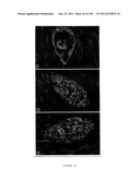 METHODS AND COMPOSITIONS FOR THE REPAIR AND/OR REGENERATION OF DAMAGED     MYOCARDIUM diagram and image