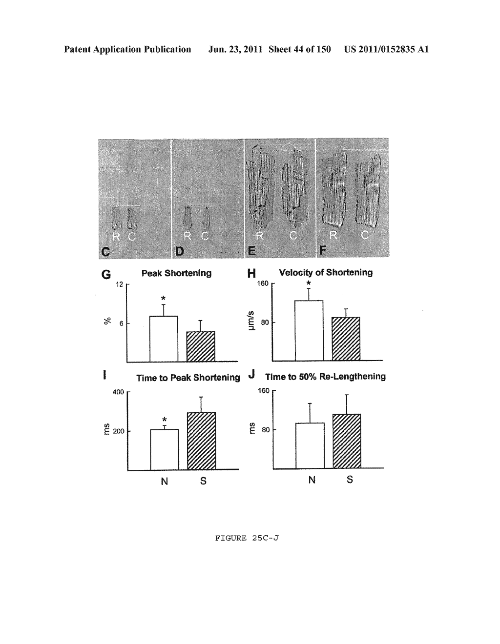 METHODS AND COMPOSITIONS FOR THE REPAIR AND/OR REGENERATION OF DAMAGED     MYOCARDIUM - diagram, schematic, and image 45