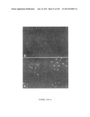 METHODS AND COMPOSITIONS FOR THE REPAIR AND/OR REGENERATION OF DAMAGED     MYOCARDIUM diagram and image