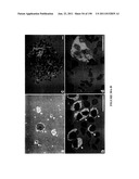 METHODS AND COMPOSITIONS FOR THE REPAIR AND/OR REGENERATION OF DAMAGED     MYOCARDIUM diagram and image