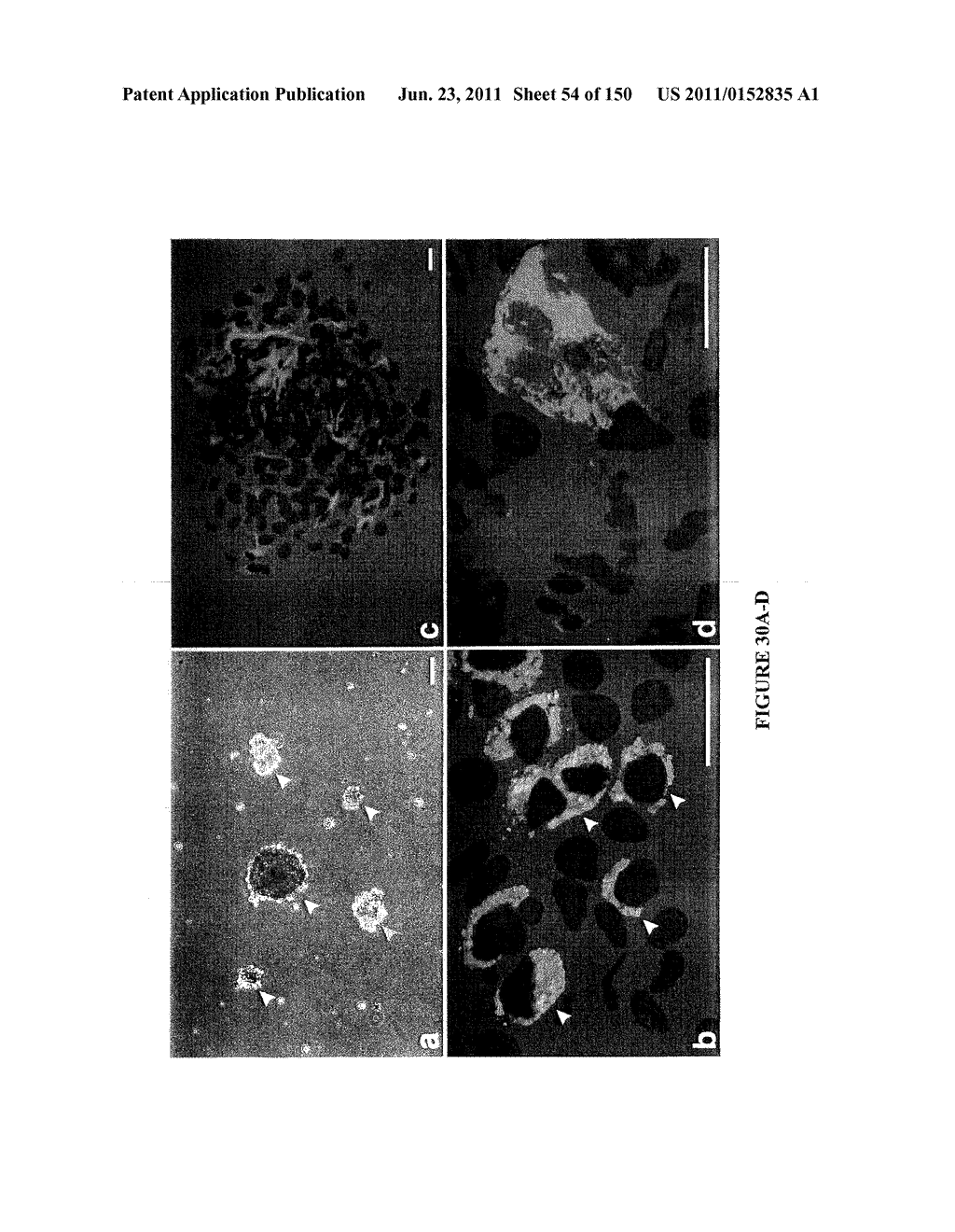 METHODS AND COMPOSITIONS FOR THE REPAIR AND/OR REGENERATION OF DAMAGED     MYOCARDIUM - diagram, schematic, and image 55