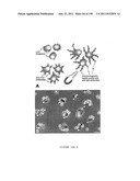 METHODS AND COMPOSITIONS FOR THE REPAIR AND/OR REGENERATION OF DAMAGED     MYOCARDIUM diagram and image