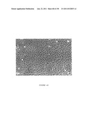 METHODS AND COMPOSITIONS FOR THE REPAIR AND/OR REGENERATION OF DAMAGED     MYOCARDIUM diagram and image