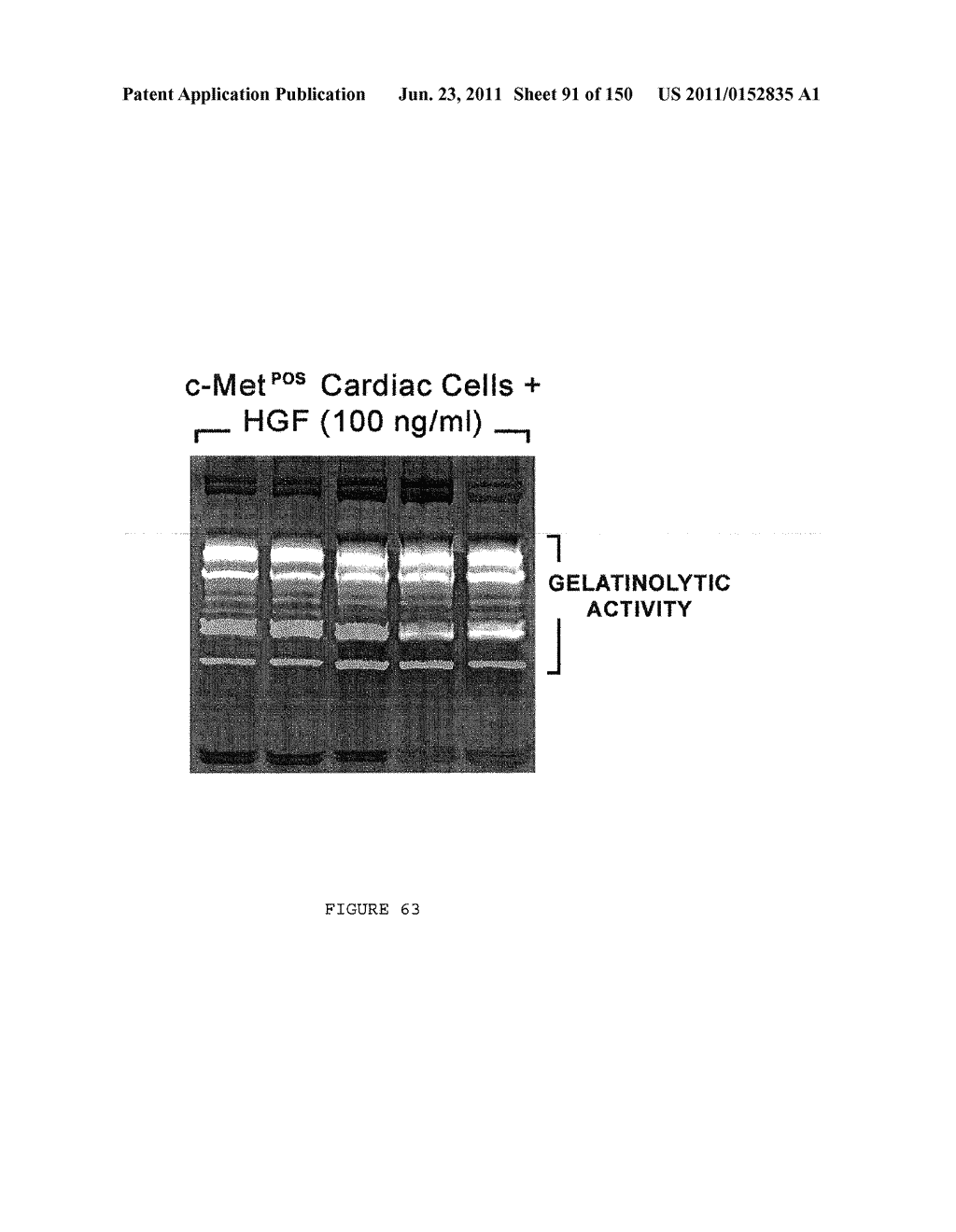 METHODS AND COMPOSITIONS FOR THE REPAIR AND/OR REGENERATION OF DAMAGED     MYOCARDIUM - diagram, schematic, and image 92