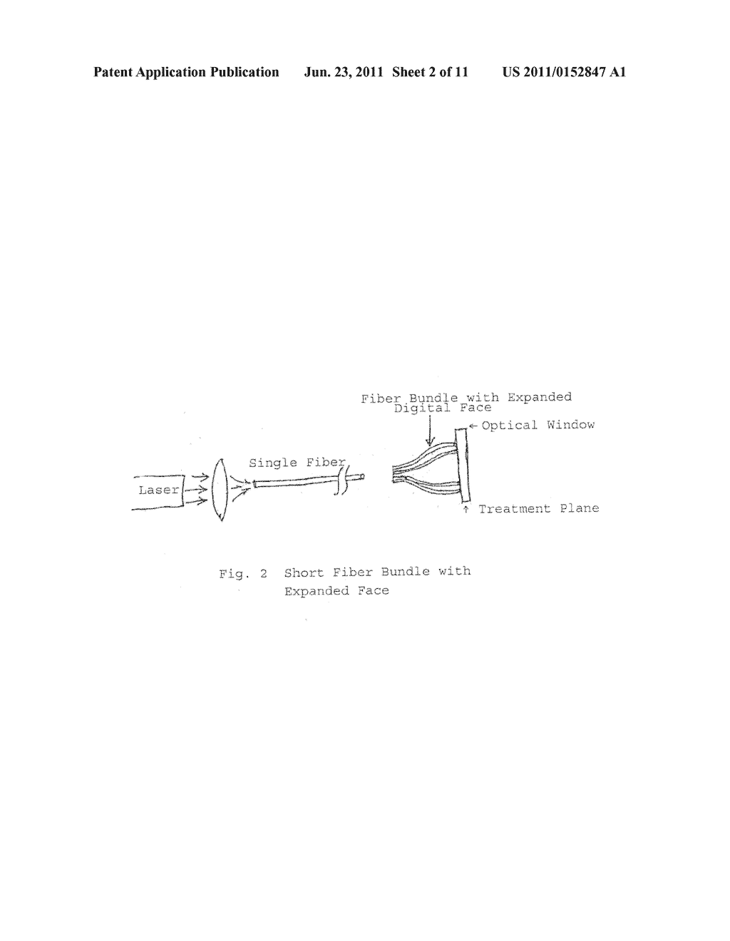 METHODS AND SYSTEMS FOR LASER TREATMENT USING NON-UNIFORM OUTPUT BEAM - diagram, schematic, and image 03