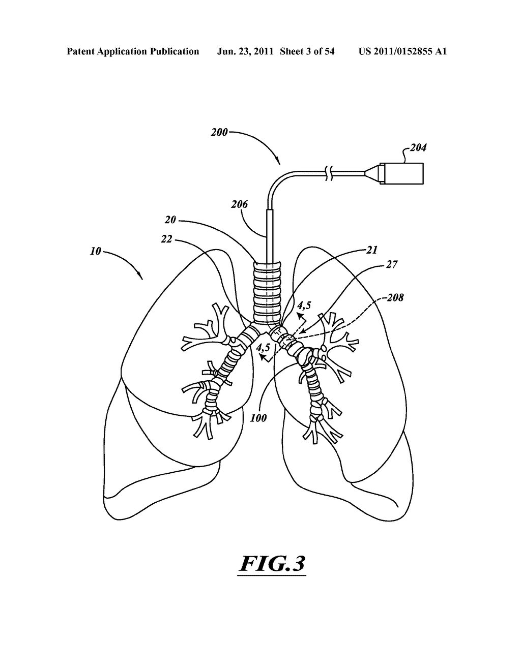 DELIVERY DEVICES WITH COOLABLE ENERGY EMITTING ASSEMBLIES - diagram, schematic, and image 04