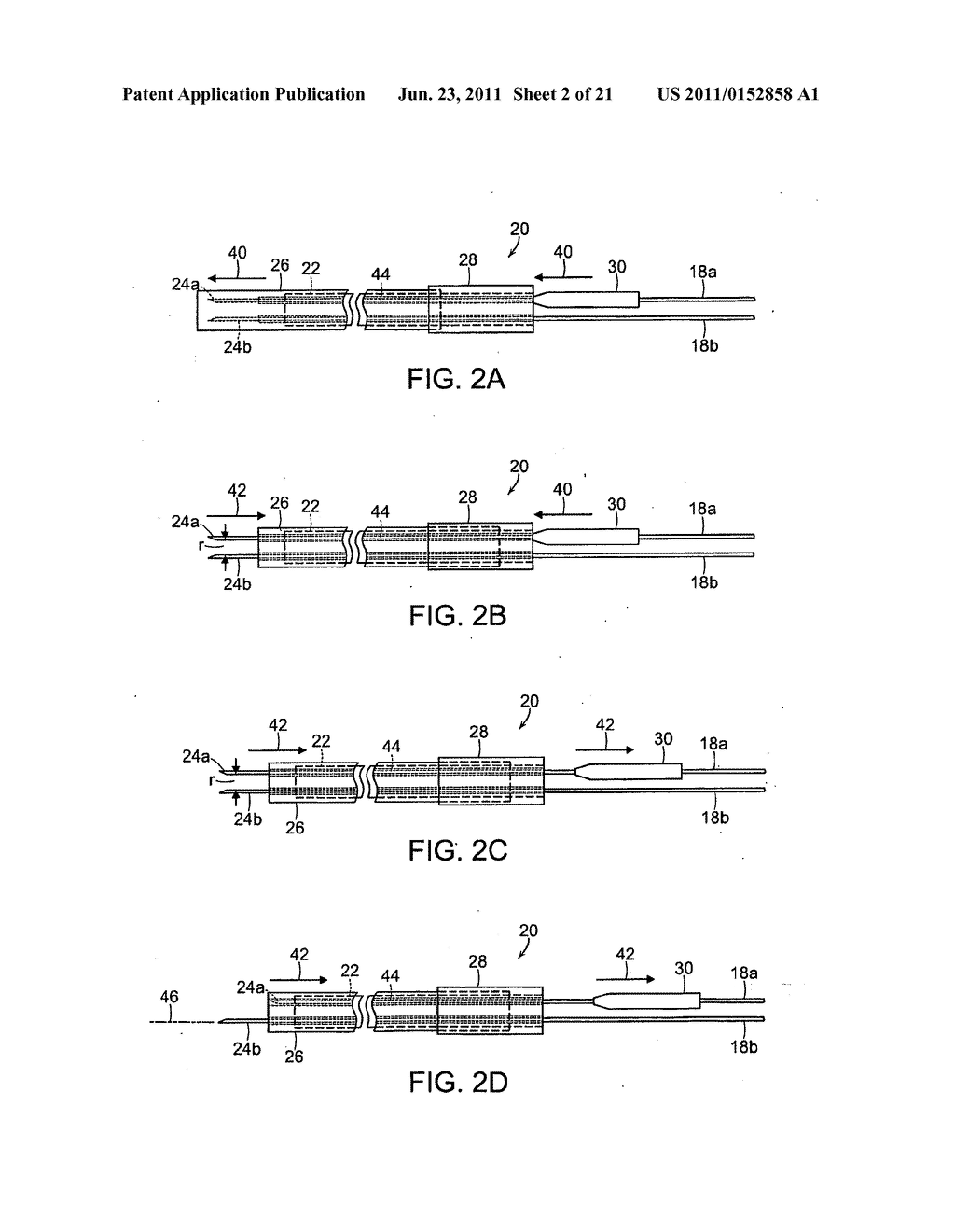 SURGICAL INSTRUMENT COMPRISING AN ELECTRODE - diagram, schematic, and image 03